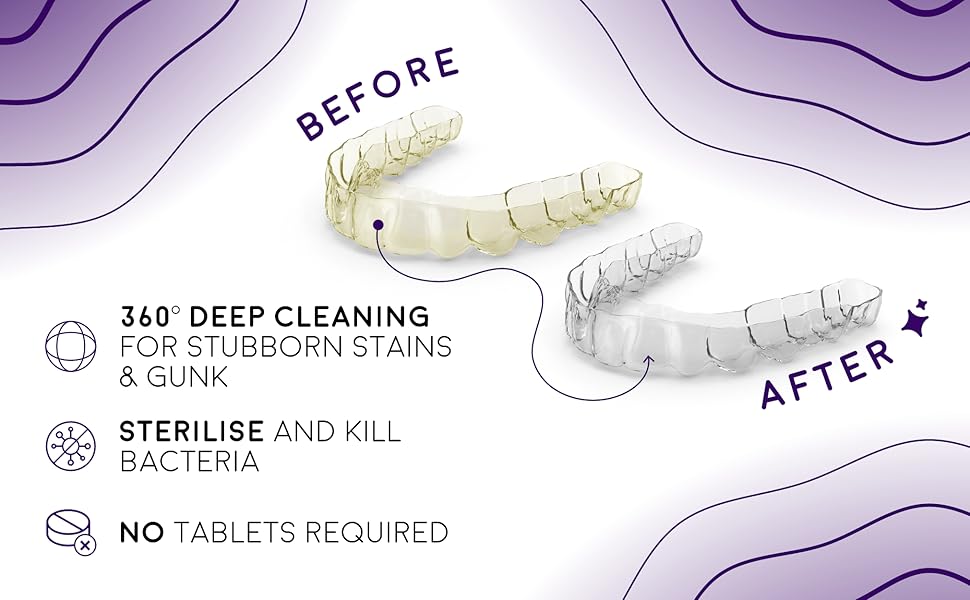 Sonic Spa Pro Ultrasonic Dental Pod Pro cleaner for retainers and aligners with advanced dual-action technology